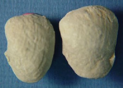 Nuculana bellistriata