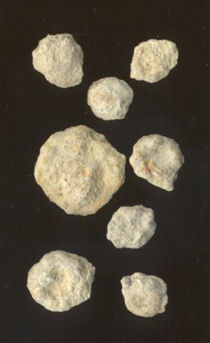 Oncolites from the Haynies Limestone bed, Ervine Creek Limestone member, Deer Creek formation, Cass County